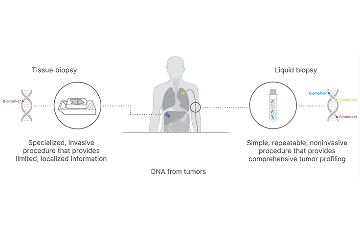 liquid biopsy diagram